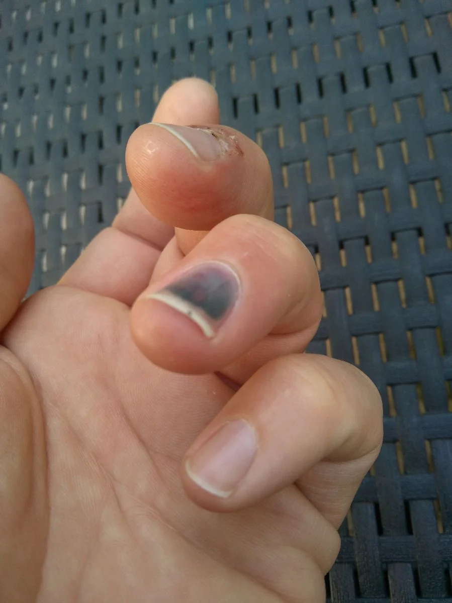 Mama macht die Heckklappe zu, Papa hat 2 Finger drin. Sieht dann so aus.